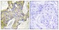 IARS2 Antibody