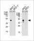 CALCR Antibody (C-term)