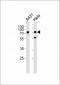 SEPT9 Antibody (C-term)