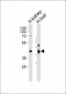 SEPT9 Antibody (C-term)