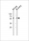 RYK Antibody