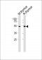 LCK Antibody (N-term)