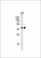 MEK1 Antibody (S218/222)