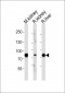 EHHADH Antibody (C-term)