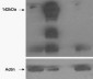 Tankyrase / TANK1 Antibody (N-Term)