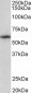 TXK Antibody (C-Term)