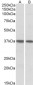 KLF2 / LKLF Antibody (N-Term)