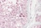 RNF36 / TRIM69 Antibody (C-Term)