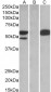 SSA1 / Ro52 Antibody (C-Term)