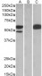 SSA1 / Ro52 Antibody (C-Term)