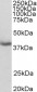 MRG15 / MORF4L1 Antibody (N-Term)