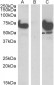 EPM2A (laforin) IP1 Antibody (N-Term)