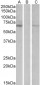 Makorin Antibody (internal region)
