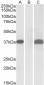 PIM2 (Internal) Antibody (internal region)