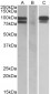 PCSK9  (aa164-175) Antibody (internal region)