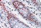 NAT10 / hALP Antibody (internal region, near the C-Term)