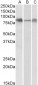 DLL4 Antibody (internal region)