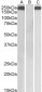 Thrombospondin (internal) Antibody (internal region)