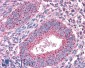 PTPRM Antibody (internal region)