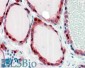 Frizzled 2 Antibody (internal region)