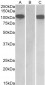 FURIN / PCSK3 Antibody (internal region)