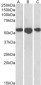 ENT1 Antibody (N-Term)