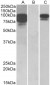 PCSK9 (aa214-228) Antibody (internal region)