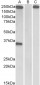 Thrombospondin Antibody (N-Term)