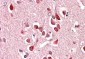 UNC5C  Antibody (internal region)