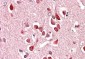 UNC5C  Antibody (internal region)