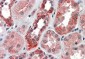 IREB2 / IRP2 Antibody (internal region)