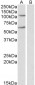 IREB2 / IRP2 Antibody (internal region)