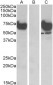 EPM2AIP1 Antibody (internal region, near C-Term)