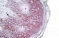 Desmoglein 1 / DSG1 Antibody (internal region)