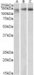 Stromal antigen 2  / STAG2 Antibody (internal region)