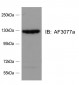 SRGAP2 Antibody (internal region)