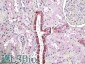 TGFBI Antibody (internal region)