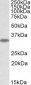 MAPRE3 (aa151-164) Antibody (internal region)