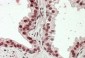HOXD13 Antibody (internal region)