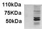 AIM2 Antibody (C-Term)