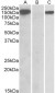 NALP2 / PAN1 Antibody (C-Term, near)