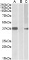 Herculin / MYF6 Antibody (internal region)