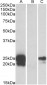 WFDC2 (aa29-43) Antibody (internal region)