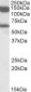 MLLT10 / AF10 Antibody (internal region)