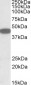 CXCR6 Antibody (C-Term)