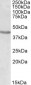 POU3F2 / BRN2 / OCT7 Antibody (internal region, near N-Term)