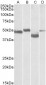 MEIS2 Antibody (internal region)