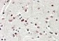 SOX3 Antibody (C-Term)