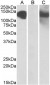 CDH11  (aa 26-37) Antibody (internal region)