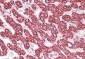 ETFB / FP585 (aa 152-165) Antibody (internal region)